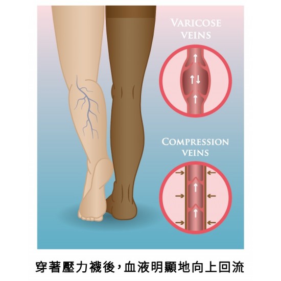 #205 Surgical close toe Tight ( length )