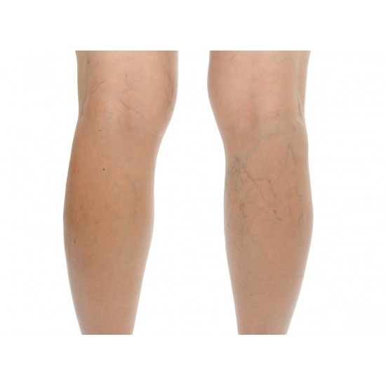 Celeste Below Knee #200 Light Beige Compression Mercury : 20mmHg-30mmHg